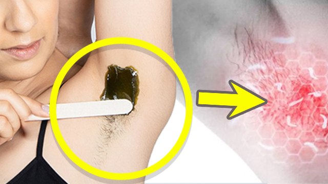 अंडरआर्म्स वैक्सिंग के बाद क्या लगाना चाहिए | Underarms Wax Ke Baad Kya Lagana Chahiye|Boldsky