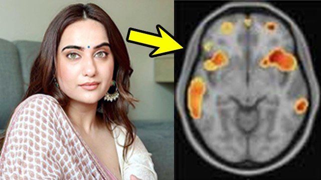 Kusha Kapila Depression: High Functional Depression क्या है, Symptoms & Treatment |Boldsky