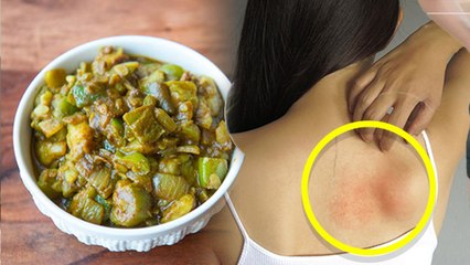 तोरई किन लोगों को नहीं खाना चाहिए | किस बीमारी में तोरई खाना मना है | Turai Khane Ke Nuksan |Boldsky