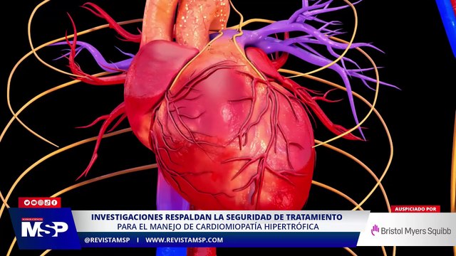 Investigaciones actuales para el manejo de la cardiomiopatía hipertrófica - #ExclusivoMSP