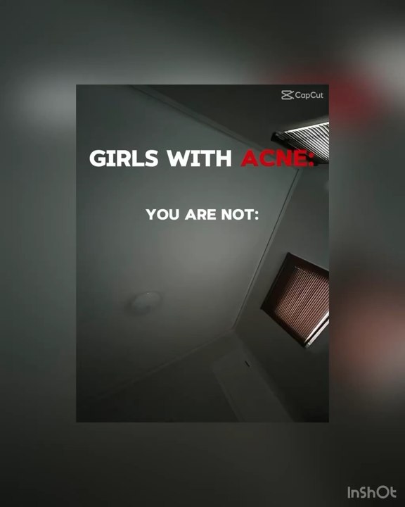 for the girls