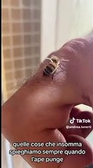 L'etologo, dopo la puntura di un'ape, mostra come estrarre il pungiglione senza panico