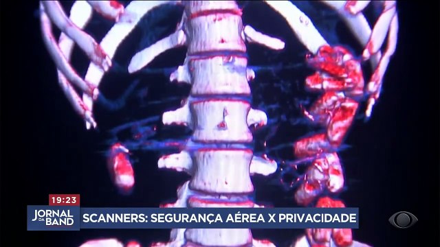 Scanner corporal em aeroportos gera discussões sobre privacidade