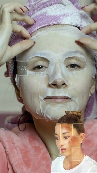 Treating skin melasma naturally #mix #NaturalRemedies