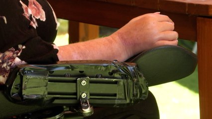 Women with disabilities fear they'll be excluded in government's domestic violence package