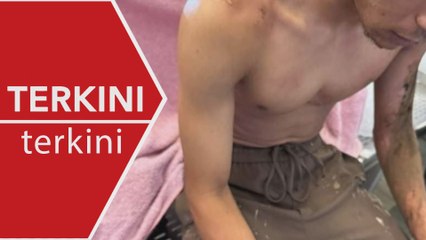 [TERKINI] Polis tahan seorang suspek berkaitan serangan asid ke atas Faisal Halim - Laporan