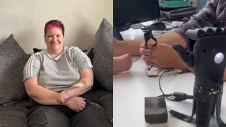 Woman operates bionic hand for the first time - before it's even put on her arm