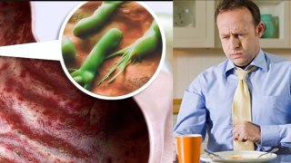 Helicobacter Pylori क्या है Symptoms Treatment In Hindi, Infection Reason Reveal| Boldsky
