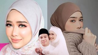 3 Rutin Haircare Fatin Afeefa Atasi Botak, Hair Alopecia!