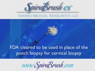 Cervical Biopsy Brush | SpiraBrush CX | Video | Biopsy Brush