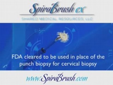 Cervical Biopsy Brush | SpiraBrush CX | Video | Biopsy Brush