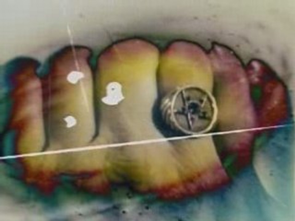 Moby - Alice [2008][SkidVid]_XviD