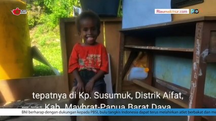Bakti Yonif 133/YS di Daerah Penugasan Membantu Seorang Anak Perempuan Penderita Hidrosefalus Sejak Lahir