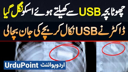 Download Video: Chota Bacha USB Se Khailte Hovy Usko Nigal Gaya - Doctor Ne USB Nikal Kar Bache Ki Jaan Bacha Li