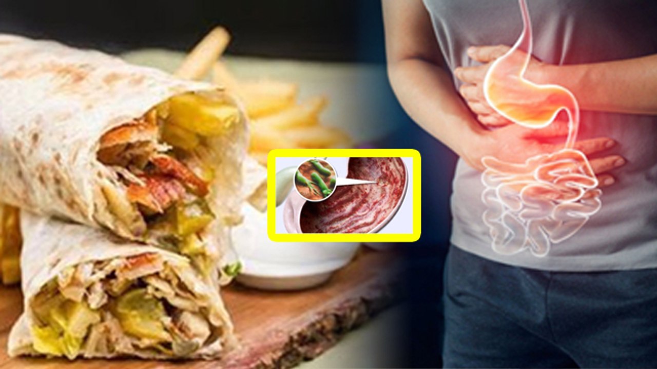 19 Year Old Man Passed Away After Eating Chicke...