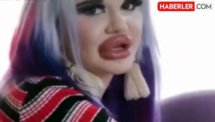 Dünyanın en büyük dudaklı kadını! Yeni hedefi ölümüne bile sebep olabilir