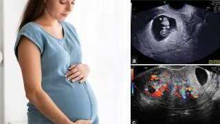 Ectopic Pregnancy Ka Ilaj Kya Hai |Ectopic Pregnancy Treatment In Hindi|Boldsky