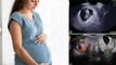Ectopic Pregnancy Ka Ilaj Kya Hai |Ectopic Pregnancy Treatment In Hindi|Boldsky