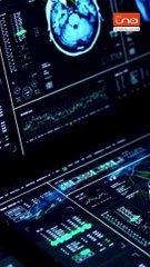 Implante en el cerebro de un Mono