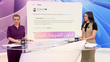 أول شخص يزرع شريحة ماسك.. كيف حالته؟