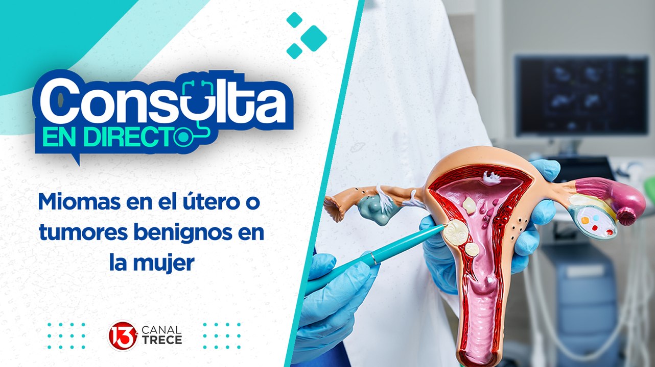Miomas o tumores benignos en la mujer | Consult...