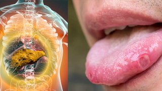 जीभ में 1 लक्षण लिवर डैमेज का संकेत | Tongue में 1 Symptom Liver Damage Reason| Boldsky