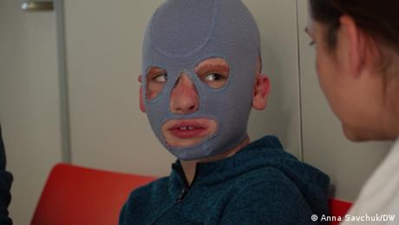 8-jähriger Ukrainer erhält Langzeittherapie in Dresden