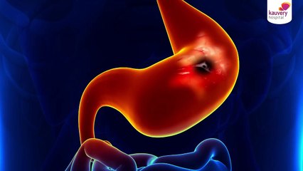 Difference Between Ulcer & Stomach Cancer | Stomach Ache