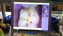 How to Install and Use 17 Inch Dental Intraoral Camera Touch LCD Screen