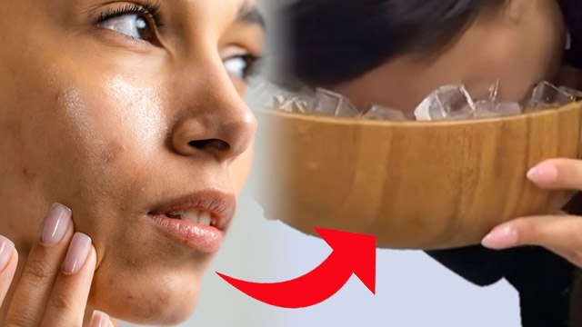 Oily या Dry Skin किसे नहीं करना चाहिए Ice F-acial | Is Ice F-acial Good For Dry Skin |