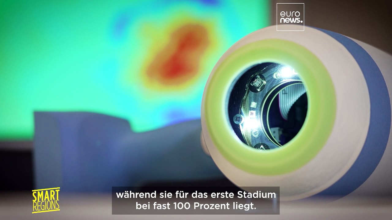 Leben retten mit einem neuen Testgerät für Hautkrebs