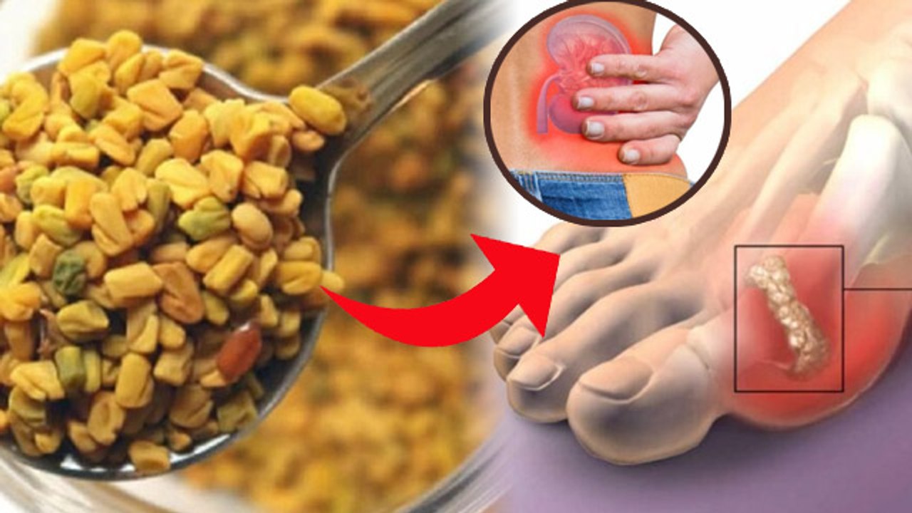 हाई यूरिक एसिड के लक्षण कम करेगा 1 मसाला | 1 Masala Se Kam Kare High Uric Acid Lakshan|Boldsky