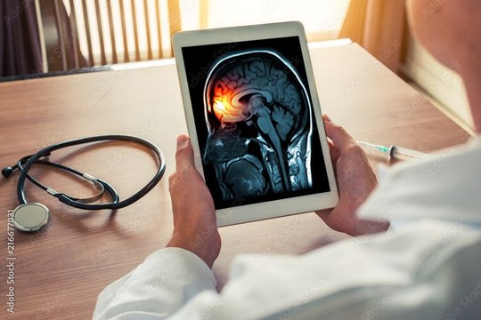 Em 2024, mais de 50 casos suspeitos de meningite foram notificados na Paraíba e dois óbitos confirmados