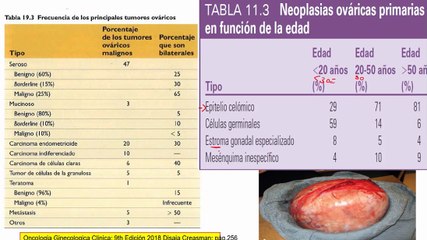 miomas astocaza[1]