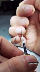 Tırnakların yiyenler artık 2 kere düşünecek! Bu video midenizi kaldırabilir