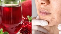 Roz Anar Ka Juice Peene Se Kya Hota Hai| Benefits Of Drinking Pomegranate Juice Daily|Boldsky