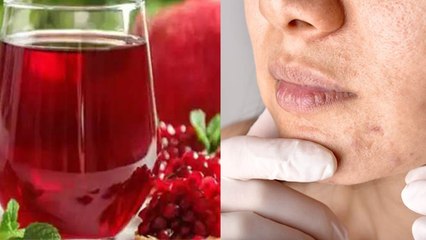 Roz Anar Ka Juice Peene Se Kya Hota Hai| Benefits Of Drinking Pomegranate Juice Daily|Boldsky