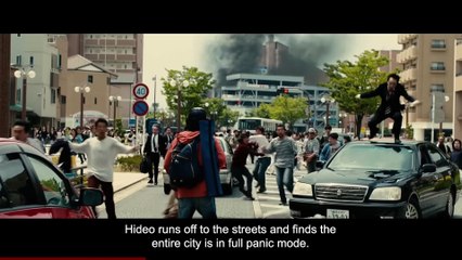 She Slept With Her Contacts In, This Is What Happened To Her Eyes