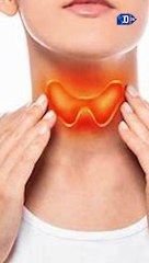 Descubren una nueva terapia contra el cáncer más agresivo de tiroides | La buena noticia