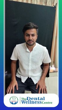 Expert Dental Braces Treatment in Ahmedabad | Top Orthodontist at Dental Wellness Center