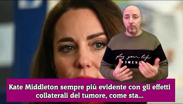 Kate Middleton sempre più evidente con gli effetti collaterali del tumore, come sta...