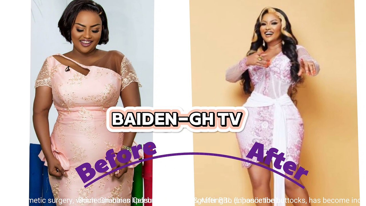 Ghanaian Celebrities Who Have Done BBL To Huge Backside