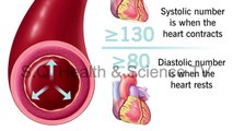 High Blood Pressure? Categories, Causes, Symptoms, Risk Factors and Management | Urdu | Hindi