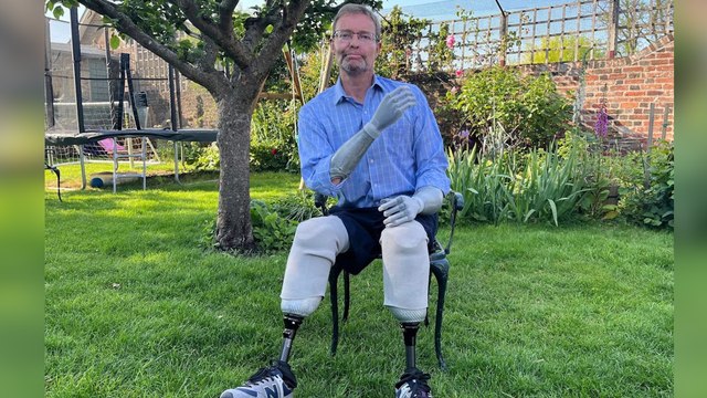 Après une amputation des quatre membres, ce député britannique fait son retour au Parlement