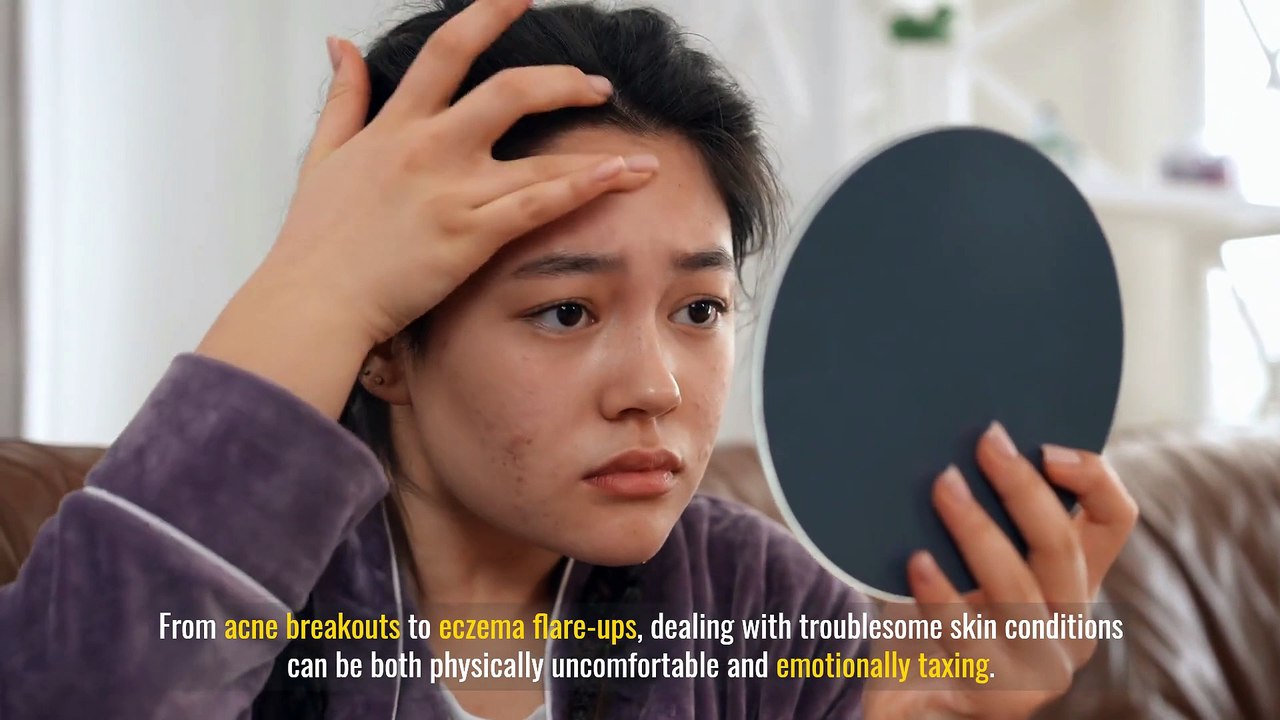 Unveiling the Power of Acupuncture for Radiant Skin