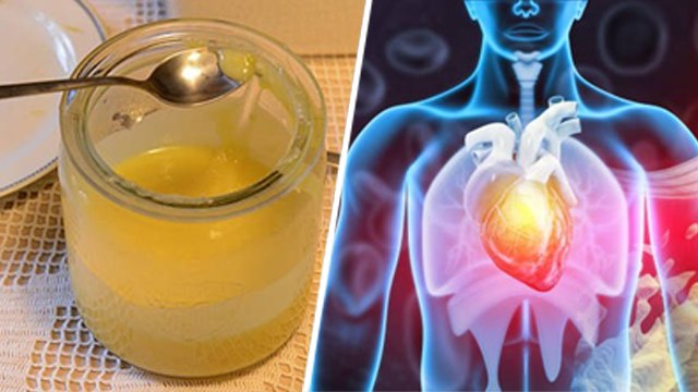 Ghee Khane Se Cholesterol Badhta Hai | घी से कोलेस्ट्रोल बढ़ता है क्या | Boldsky