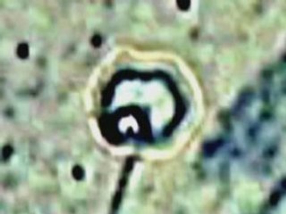 Morgellon_SilentSuperBugQuorum2