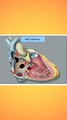 congenital heart defect ( CHD ) || जन्मजात हृदय रोग के लक्षण || जन्मजात हृदय रोग के प्रकार