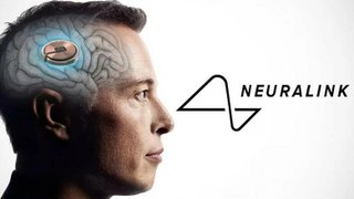 نيورالينك تستعد لزراعة شريحة جديدة في الدماغ