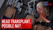 Head transplant, posible na? | GMA Integrated Newsfeed